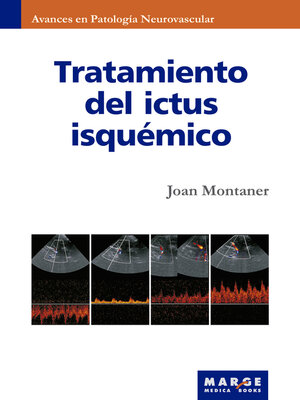 cover image of Tratamiento del ictus isquémico
